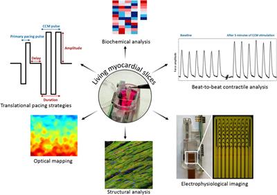 Commentary: Acute effects of cardiac contractility modulation stimulation in conventional 2D and 3D human induced pluripotent stem cell-derived cardiomyocyte models